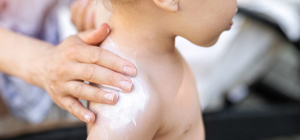 Zonnebrandcrème voor je baby: welke kies je?