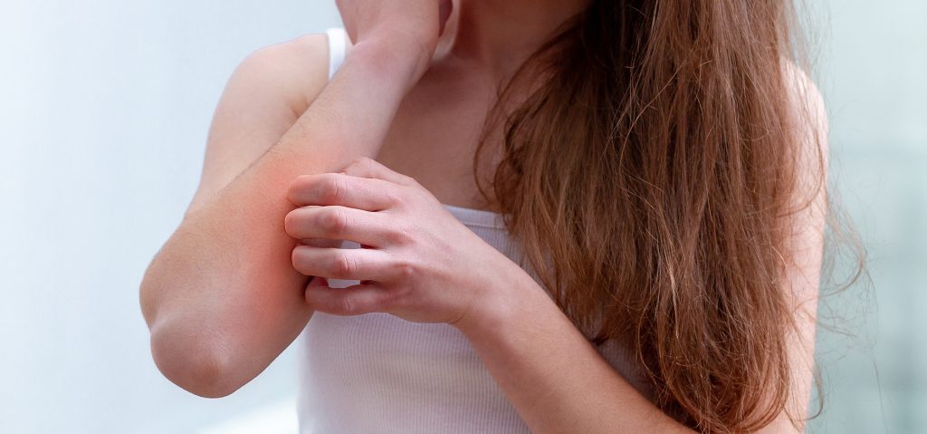 Allergische reacties: wat het zijn en wat je kunt doen