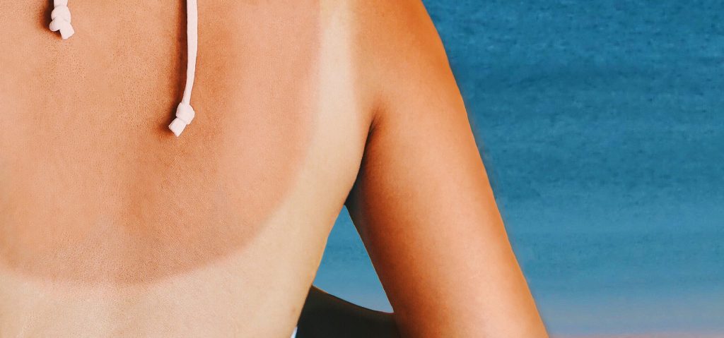 Snel bruin worden? Pak het anders aan