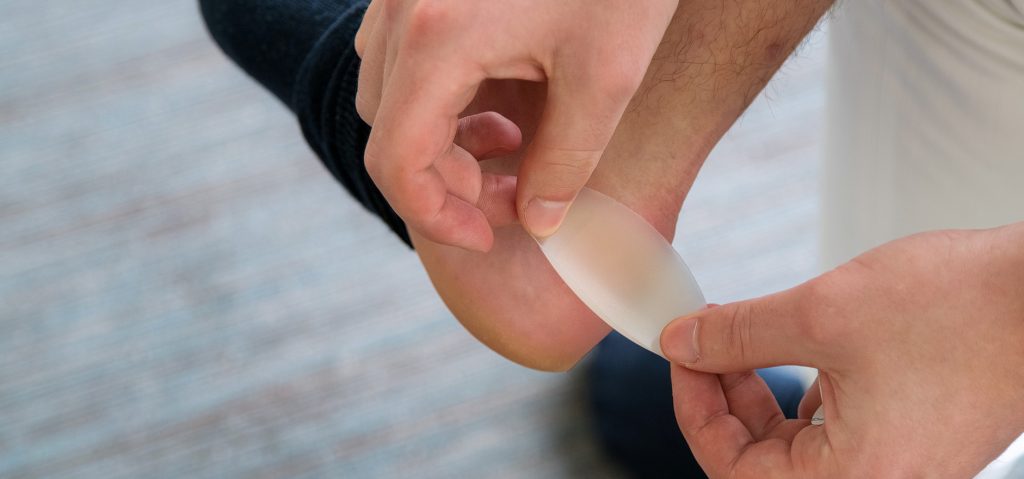 Bloedblaar: alles over deze blaren