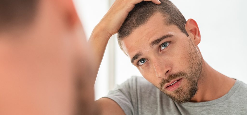 Kaal worden: alles wat je wilt weten