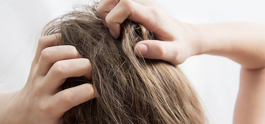 Luizen: kleine beestjes, grote geheimen!