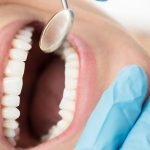 Hoe herken je tandvleesproblemen?