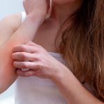 Réactions allergiques: c’est quoi et quels sont les remèdes?