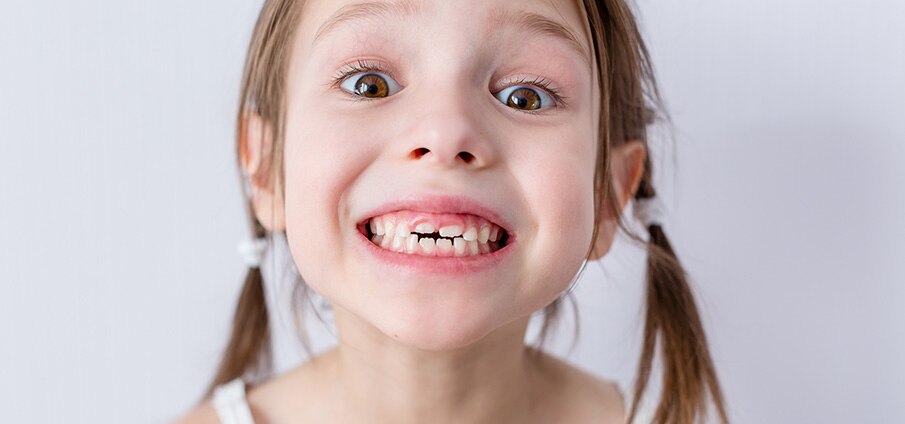 Tanden wisselen: wanneer wisselen kinderen? Tanden wisselen: wanneer wisselen kinderen?