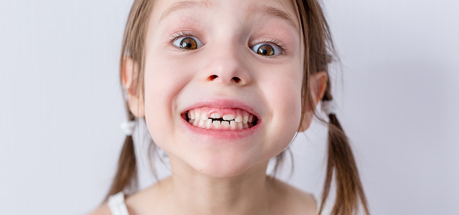 Quand les enfants perdent-ils leurs dents de lait ? Quand les enfants perdent-ils leurs dents de lait ?