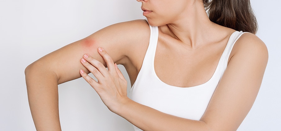 Dengue: symptomen, mug herkennen en preventie