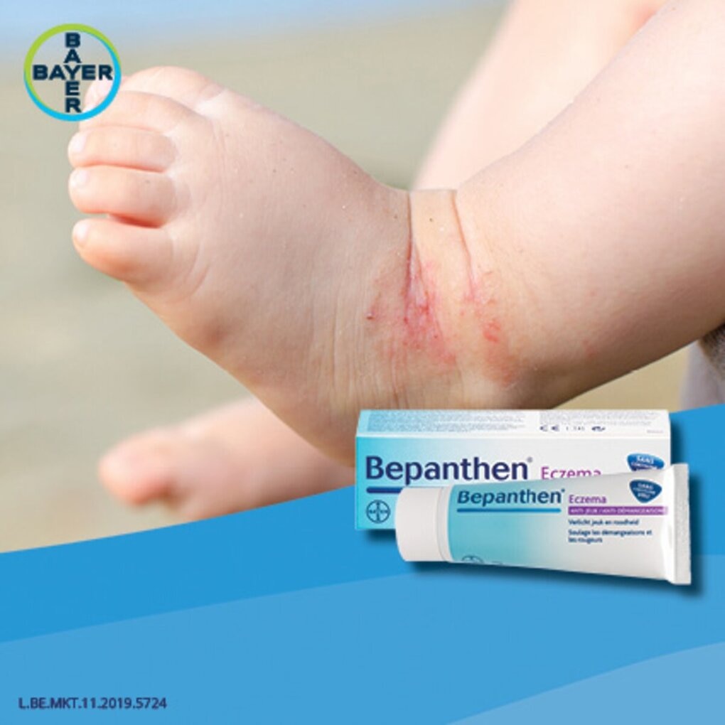 Bepanthen Eczema Anti-jeuk Crème