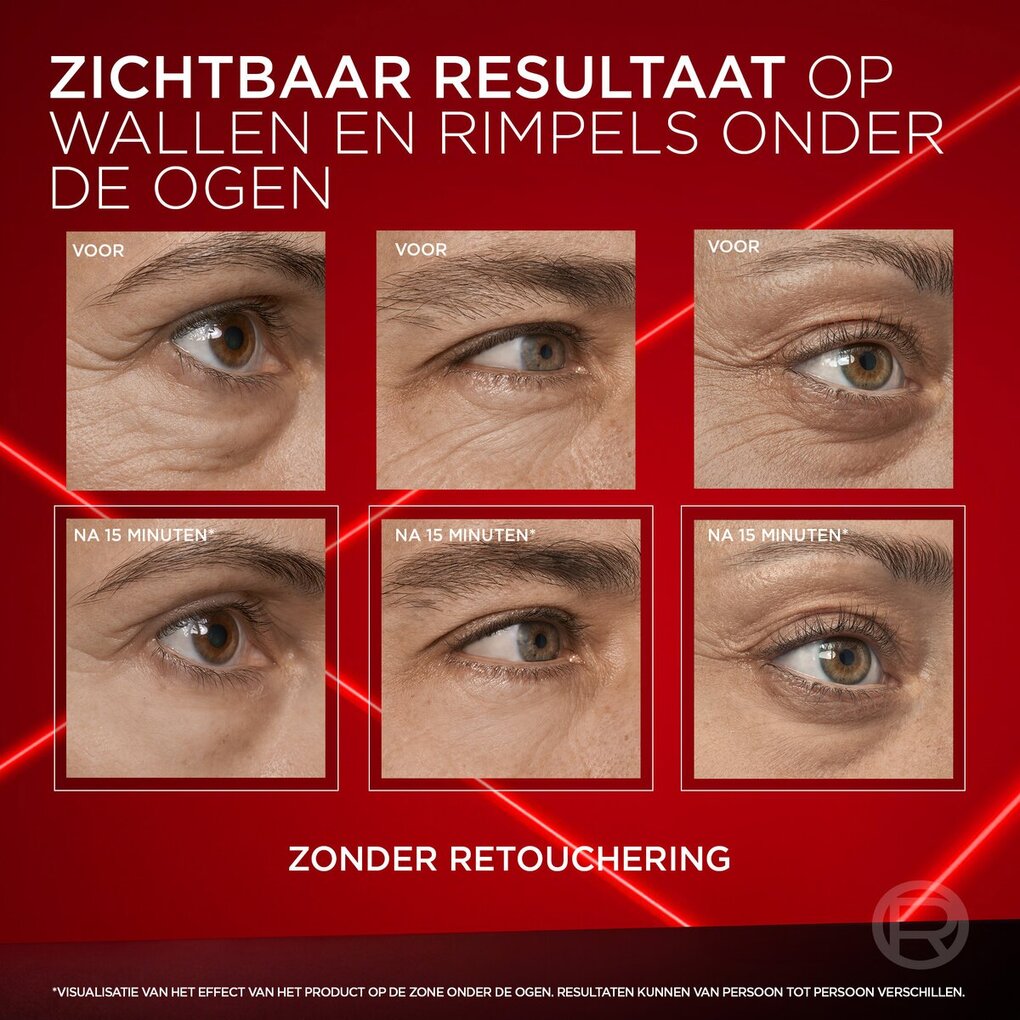 L'Oréal Paris Revitalift Laser Instant Eye Bag Eraser