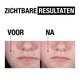 Neutrogena Clear & Defend Peeling Wasgel
