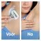 Gillette Venus Lames de Rechange Party Edition