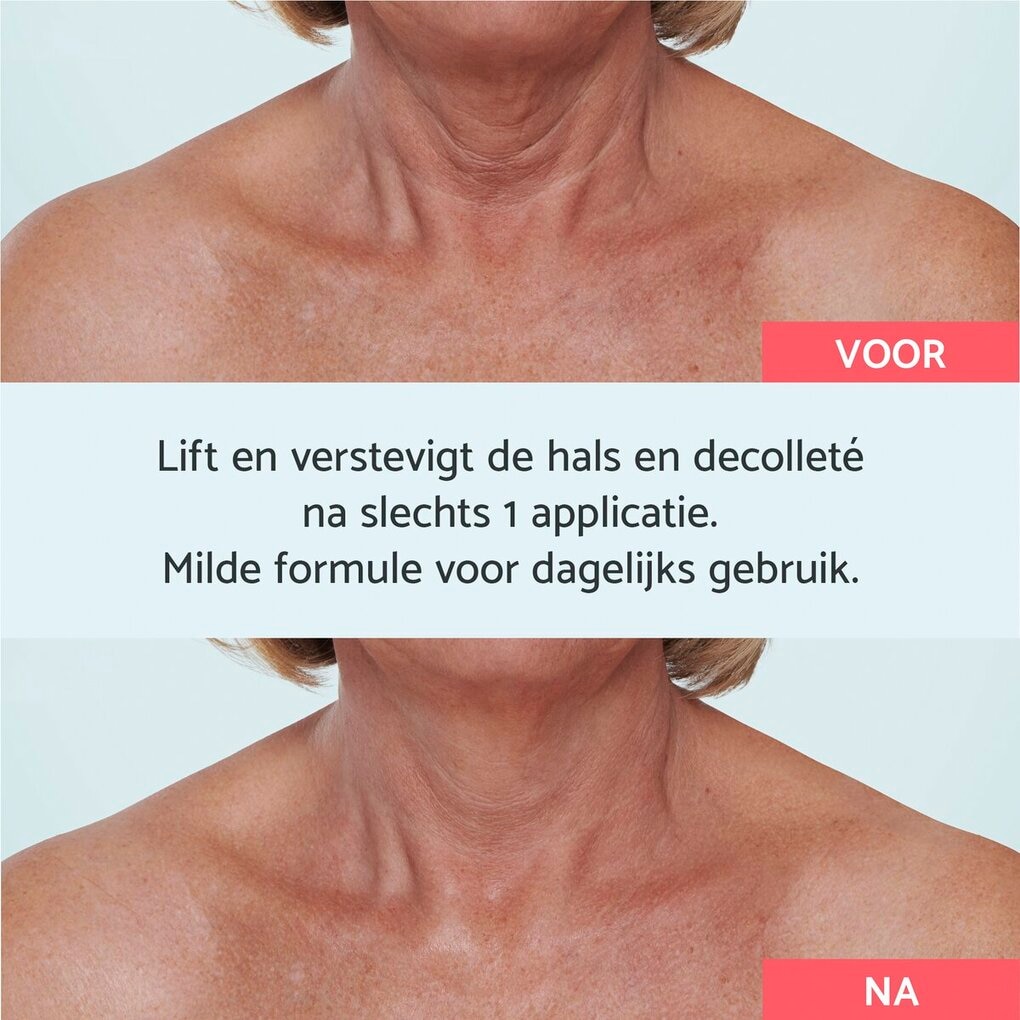 Remescar Hals & Décolleté Crème