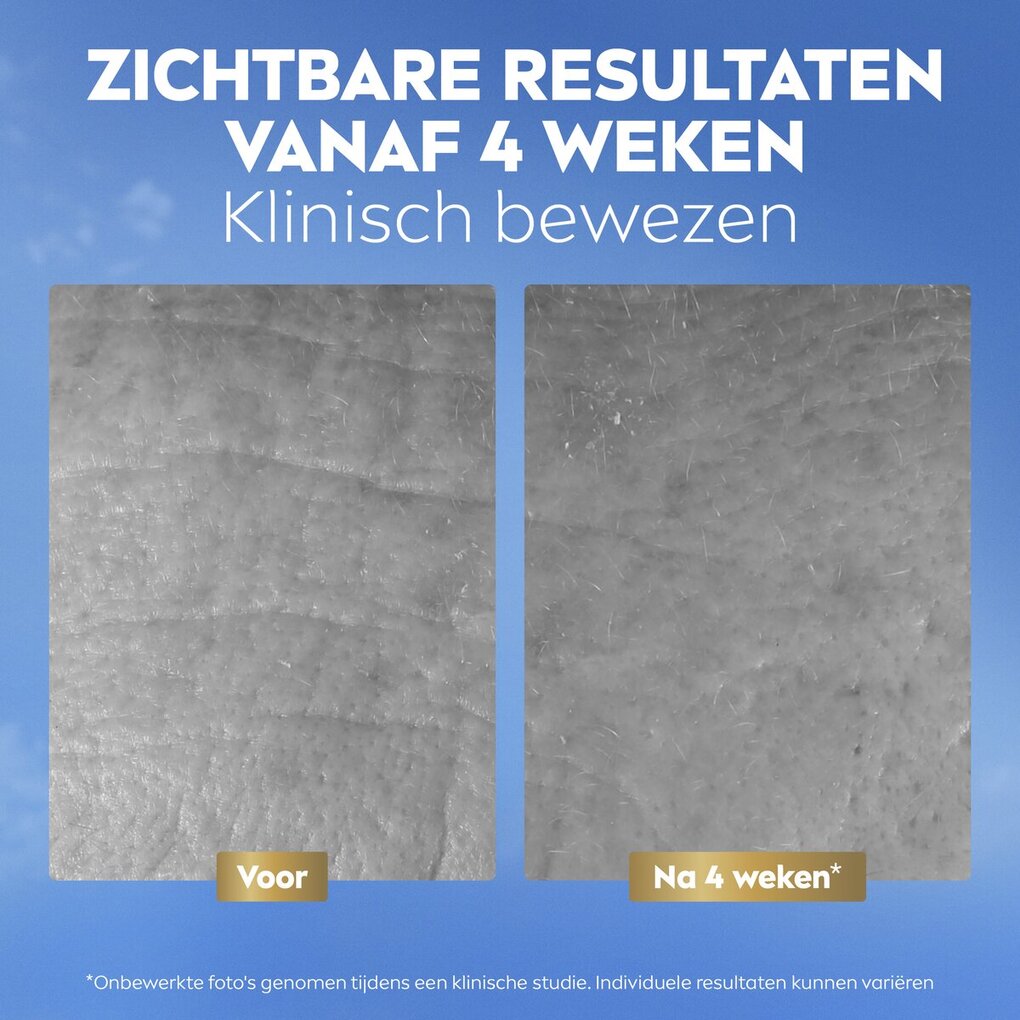 NIVEA Q10 Anti-Rimpel Collageen Expert Dag- en Nachtbalsem