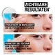 Neutrogena Sérum 10% Niacinamide Hydro Boost Sans Parfum